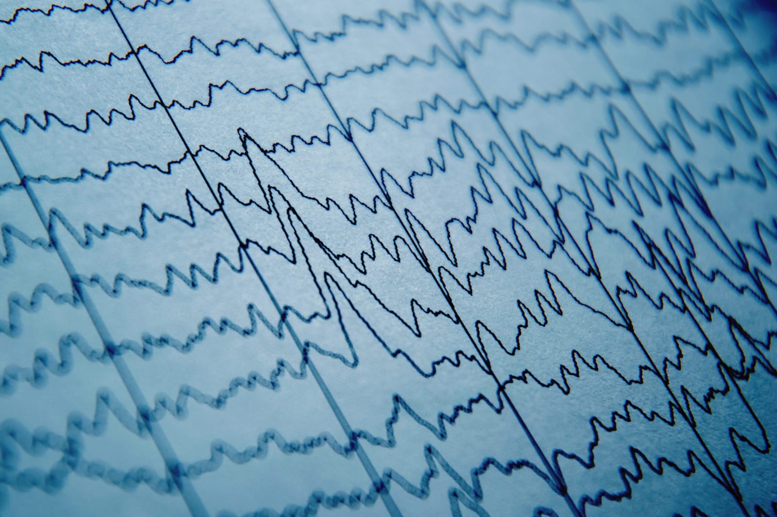Machine Learning to Predict Anesthesia Depth from EEG